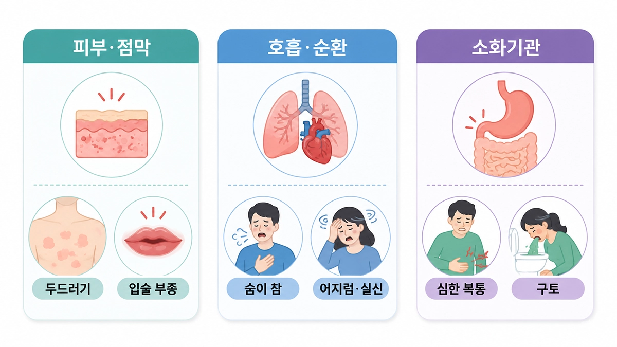 아나필락시스 증상을 피부·점막, 호흡·혈액순환, 소화기관으로 구분한 비교 인포그래픽