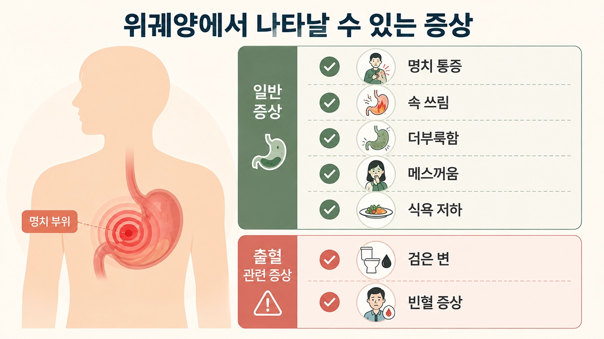 위궤양 증상인 명치 통증과 속 쓰림, 메스꺼움, 검은 변을 정리한 체크리스트