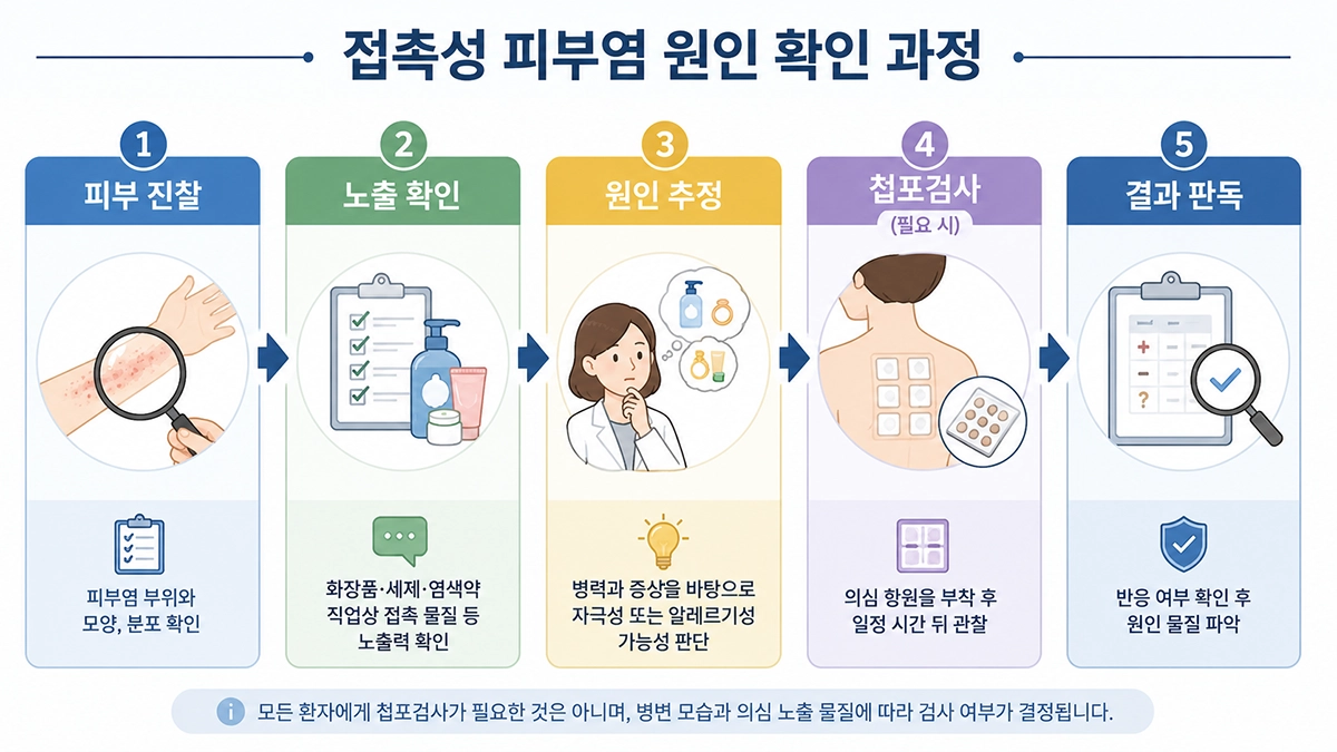 접촉성 피부염 진단에서 피부 진찰과 노출 확인 후 필요 시 첩포검사를 시행하는 과정