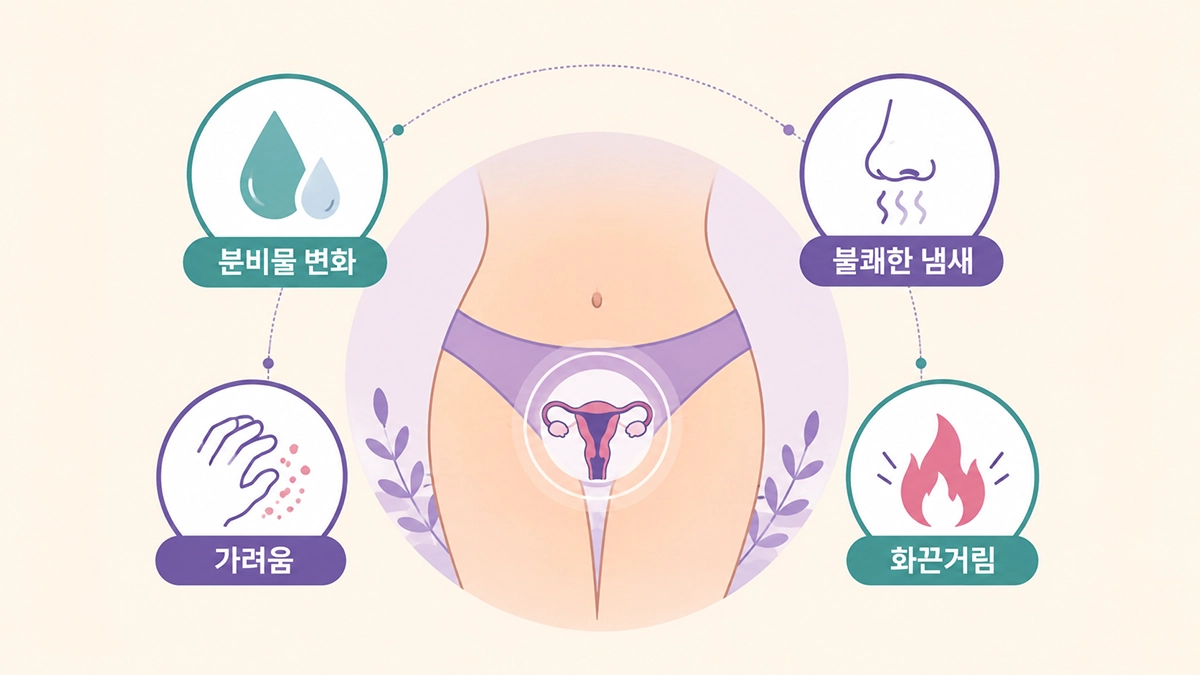 질염 증상으로 나타날 수 있는 분비물 변화와 냄새, 가려움, 화끈거림 인포그래픽
