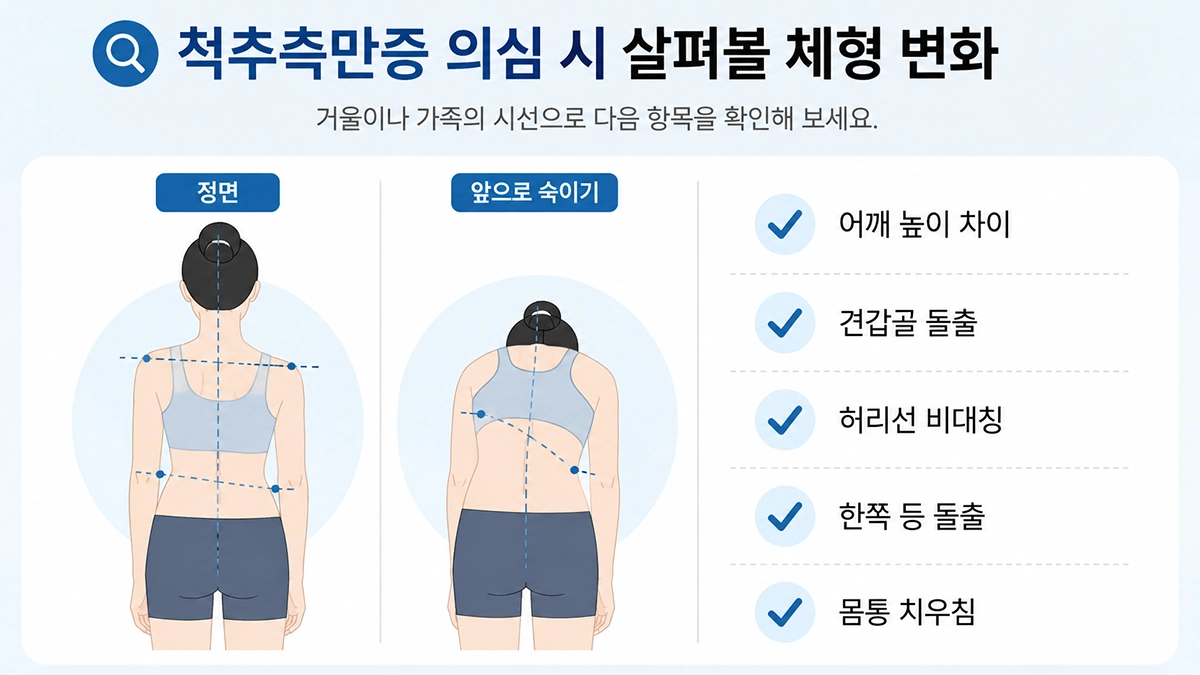 척추측만증에서 살펴볼 수 있는 어깨 높이와 견갑골, 허리선의 좌우 비대칭