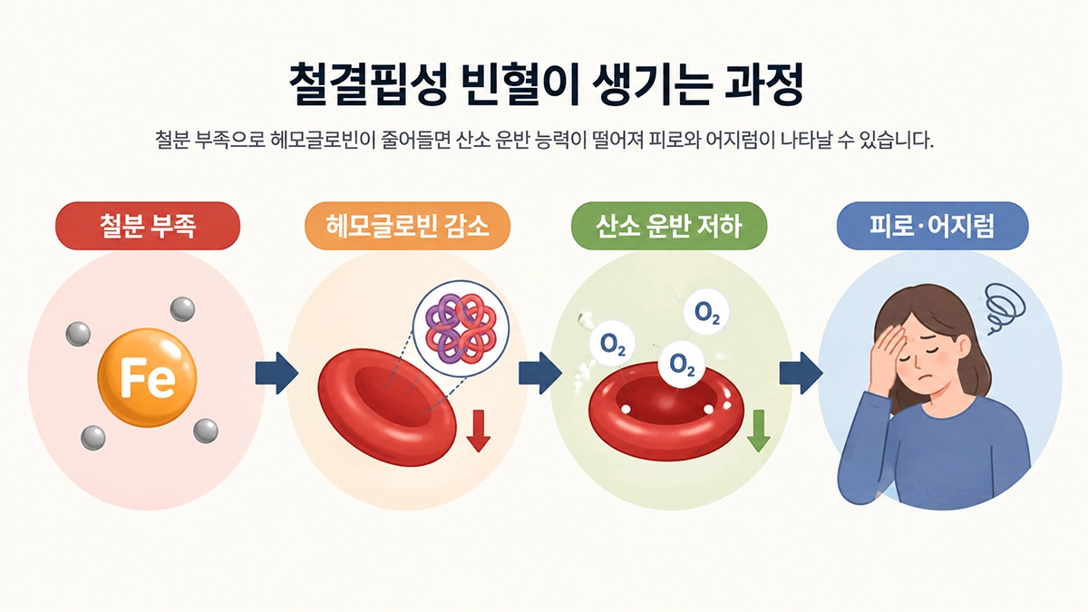 철결핍성 빈혈에서 철분 부족으로 헤모글로빈과 산소 운반이 감소하는 과정