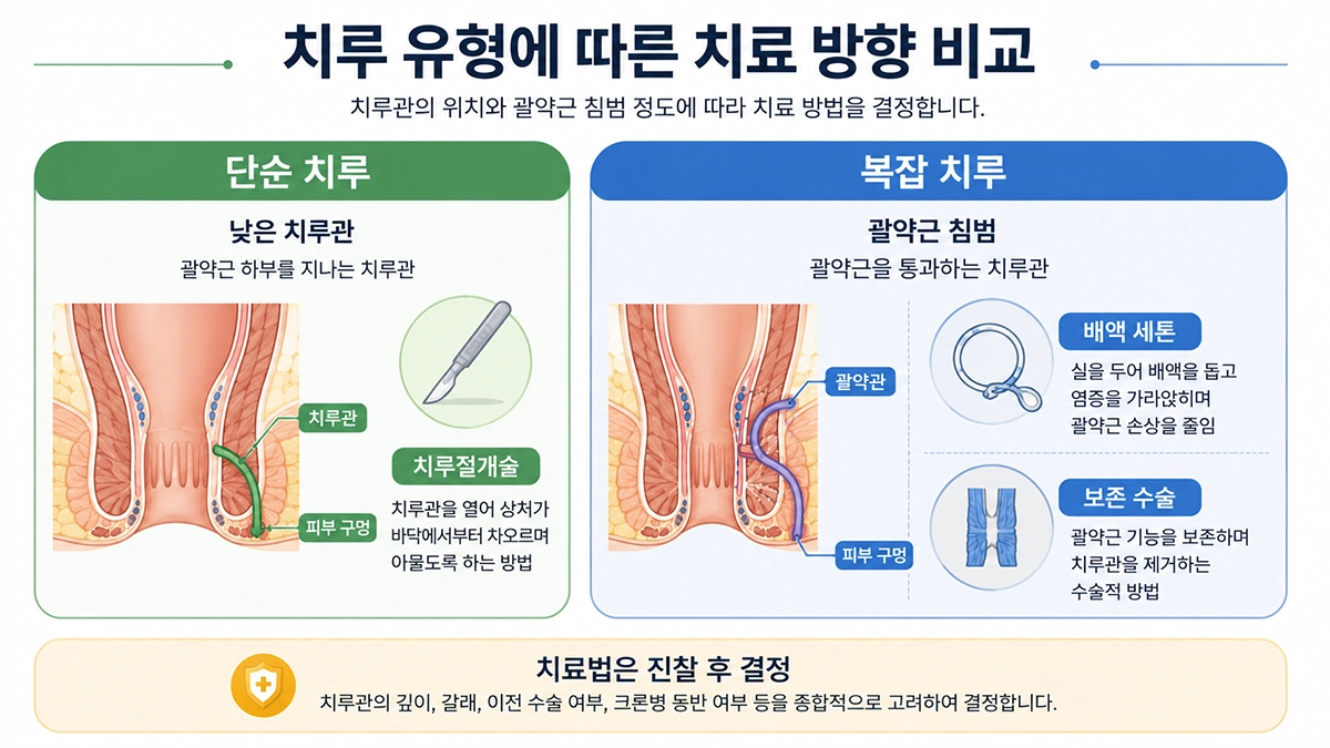 치루 위치와 괄약근 침범 정도에 따른 수술 치료 방법 비교