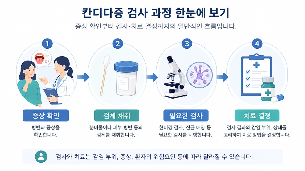 칸디다증의 증상 확인부터 검사와 치료 결정까지 일반적인 진료 과정을 보여주는 인포그래픽