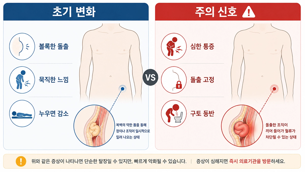 탈장 초기 증상과 감돈·교액이 의심되는 응급 신호를 비교한 인포그래픽