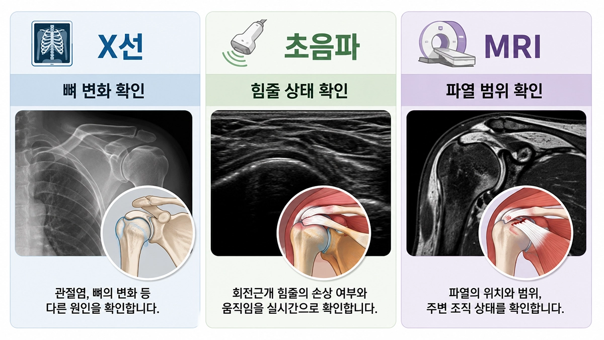 회전근개파열 검사에 사용되는 X선 초음파 MRI의 확인 내용을 비교한 인포그래픽