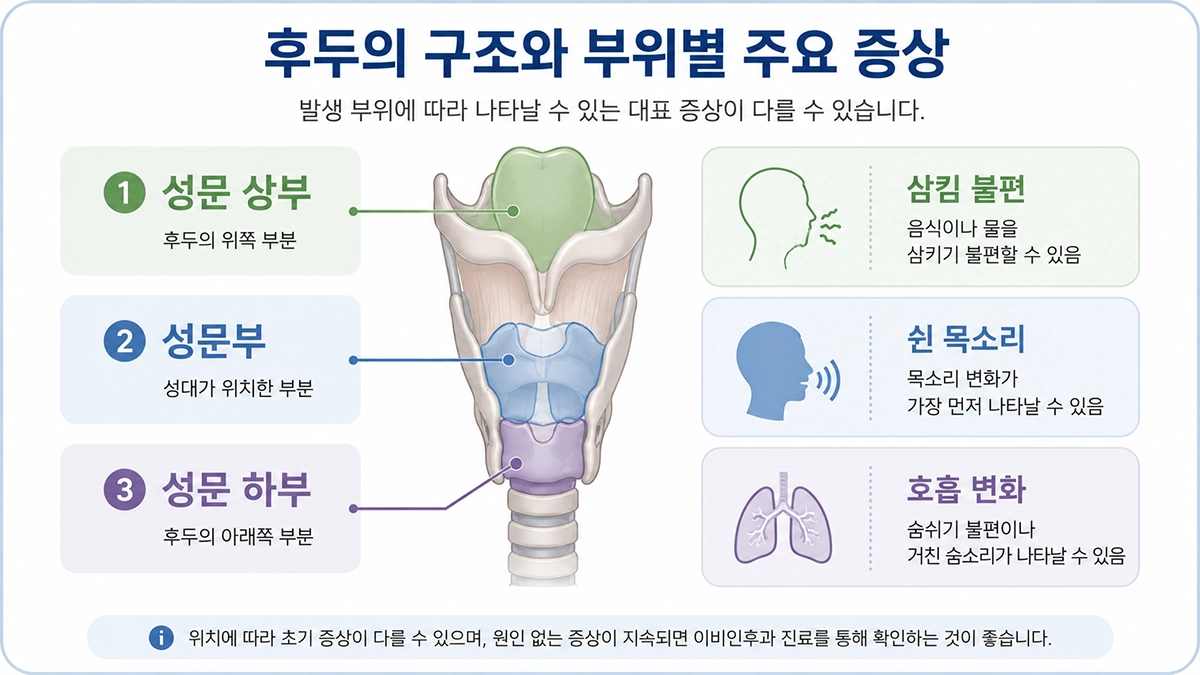 후두암 초기증상 차이를 이해할 수 있도록 성문 상부 성문부 성문 하부를 비교한 인포그래픽