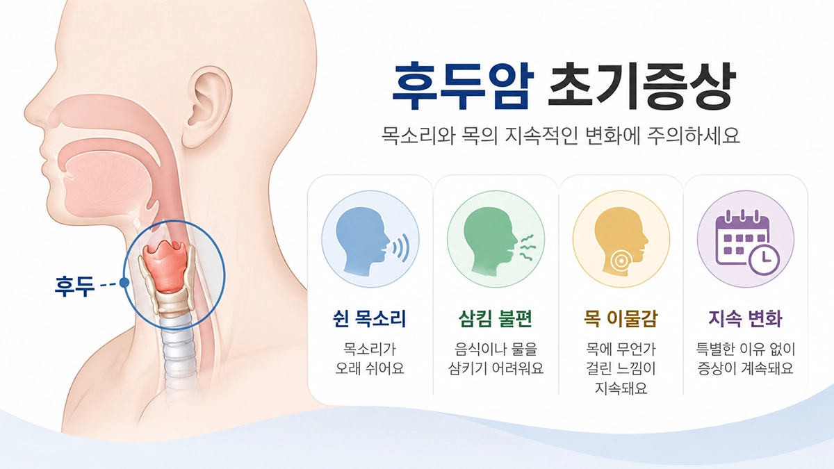 후두암 초기증상으로 나타날 수 있는 쉰 목소리와 삼킴 불편을 설명하는 후두 위치 인포그래픽