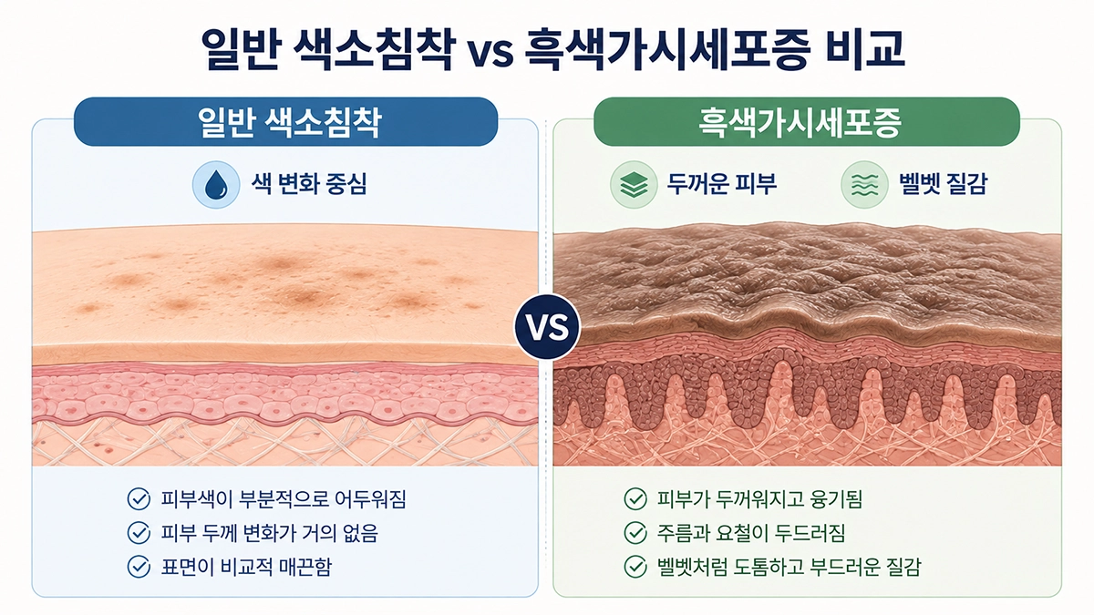 흑색가시세포증과 일반적인 색소침착의 피부 색과 질감 차이를 비교한 이미지