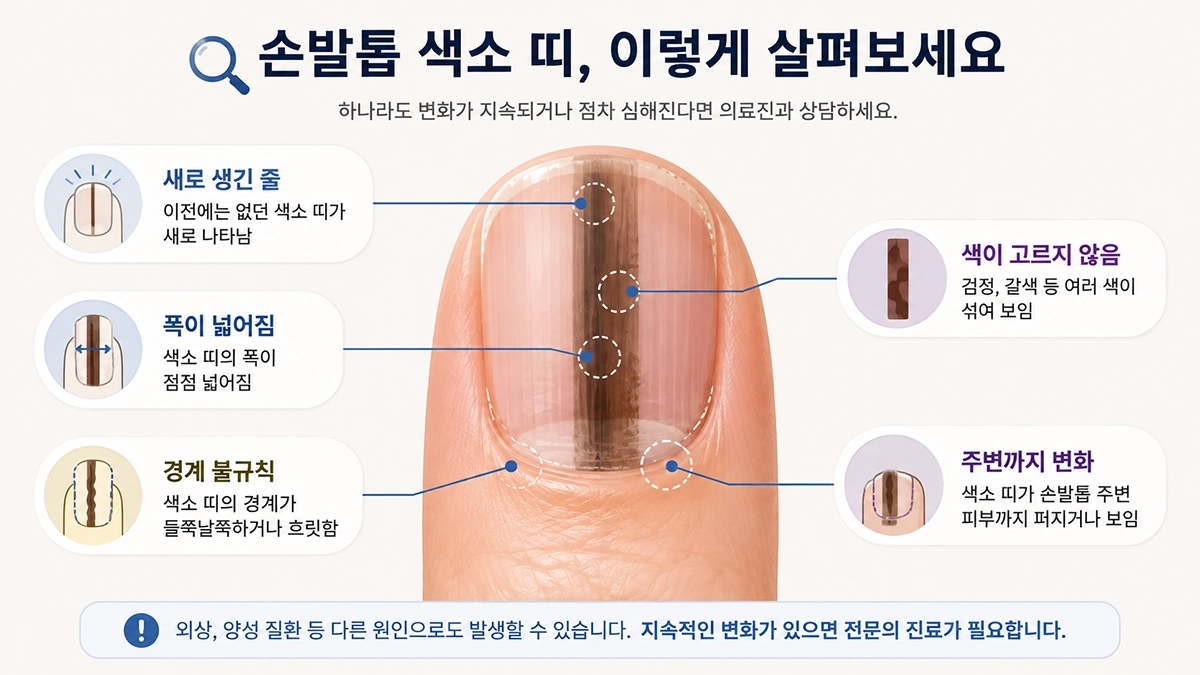 흑색종 가능성을 확인할 때 살펴볼 손발톱 검은 줄과 색소 변화