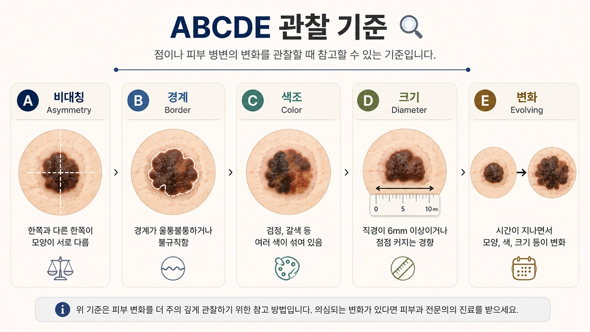 피부암 초기증상과 흑색종 점 변화를 살펴보는 ABCDE 기준 인포그래픽